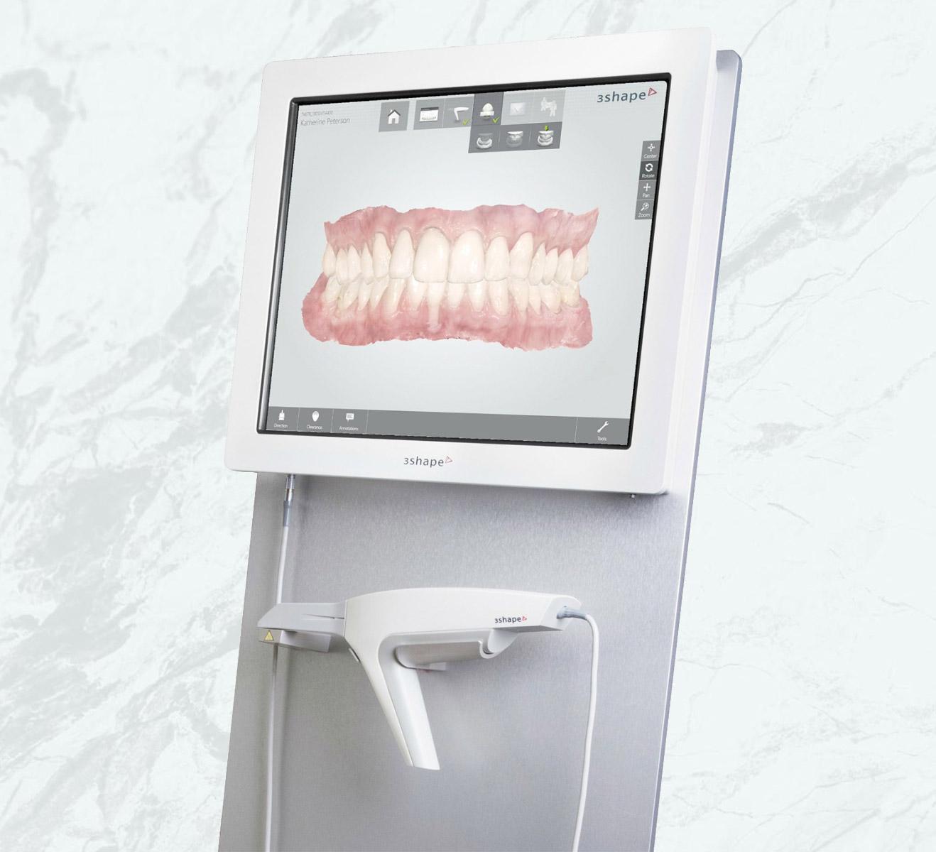 de-wit-gebit-digitale-mondscanner
